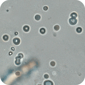 Жировые капли