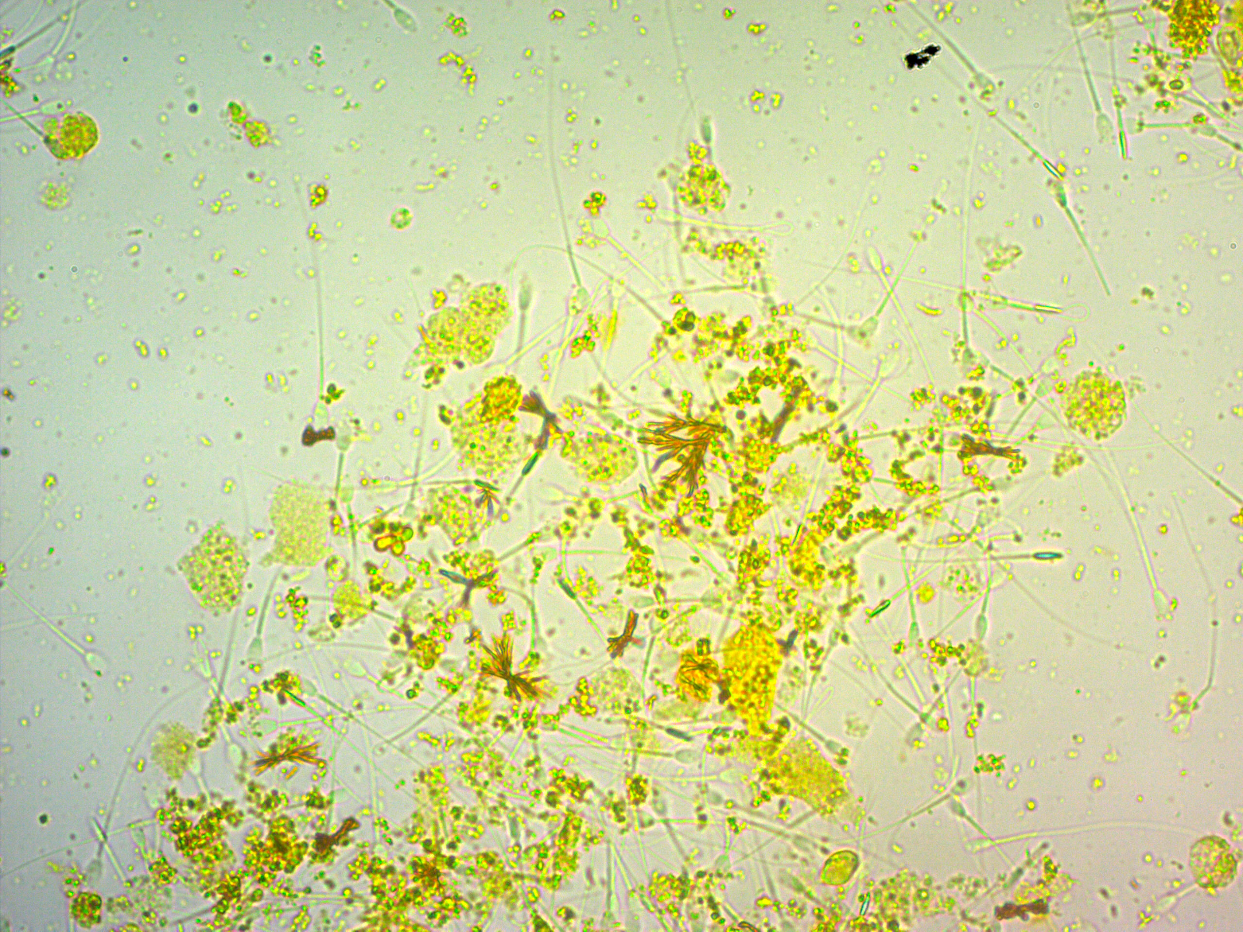 Кристаллы билирубина в моче у собаки | Атлас ветеринарной академии ...