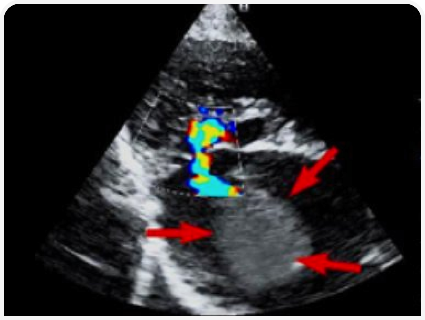 FOCUS-334-Leonard-Figure-2 (1).png