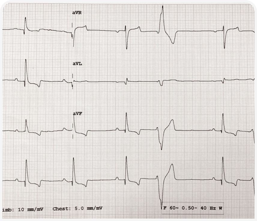 VF_313_Article-Stern-Figure-2 1 (1).png