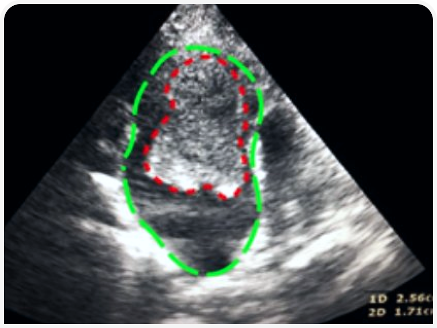 FOCUS-334-Leonard-Figure-2 (2).png
