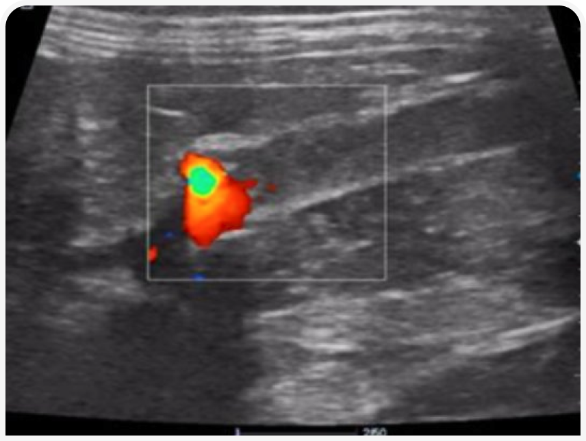 FOCUS-334-Leonard-Figure-2 (3).png