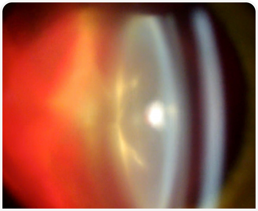 FOCUS (6).png