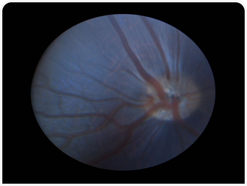 FOCUS (2).png