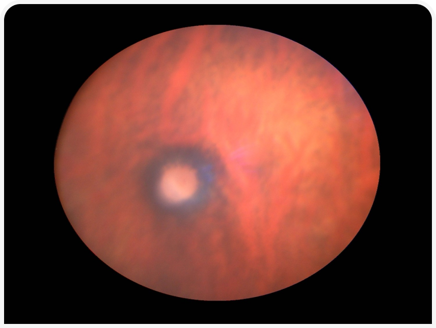 FOCUS (17).png