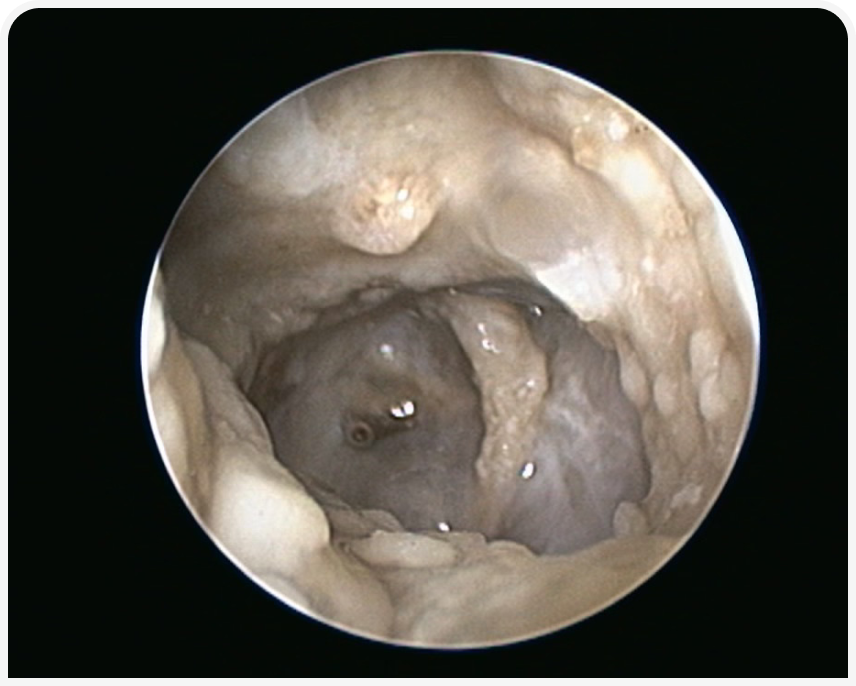 FOCUS-334-Leonard-Figure-4 (4).png