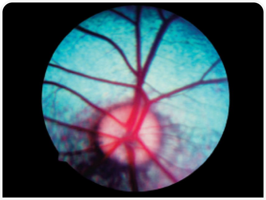FOCUS (9).png
