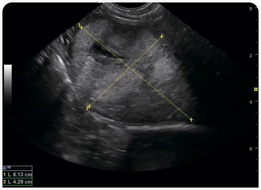 FOCUS-334-Leonard-Figure-4 (1).png
