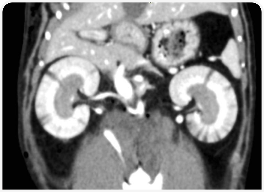 FOCUS-334-Leonard-Figure-4 (1).png