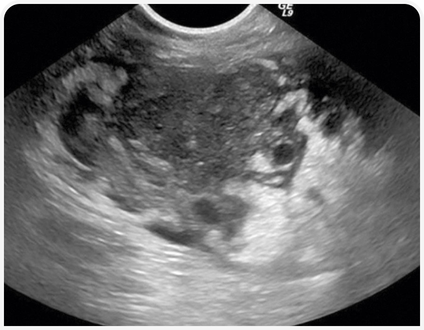 FOCUS_322_ELLIOTT_Figure-3 1.png