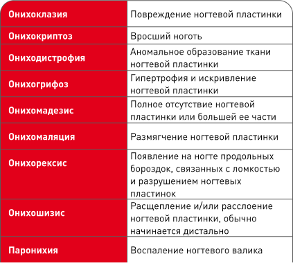 Table.png