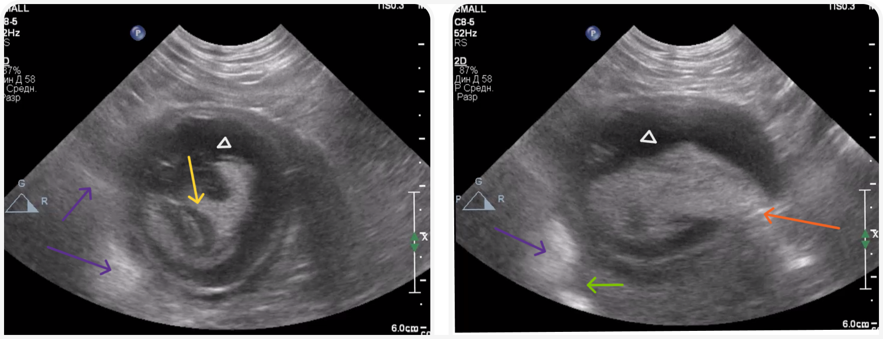 fig 1 (6).png