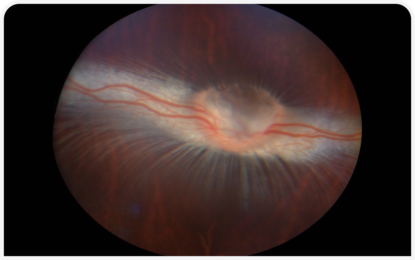 FOCUS (13).png
