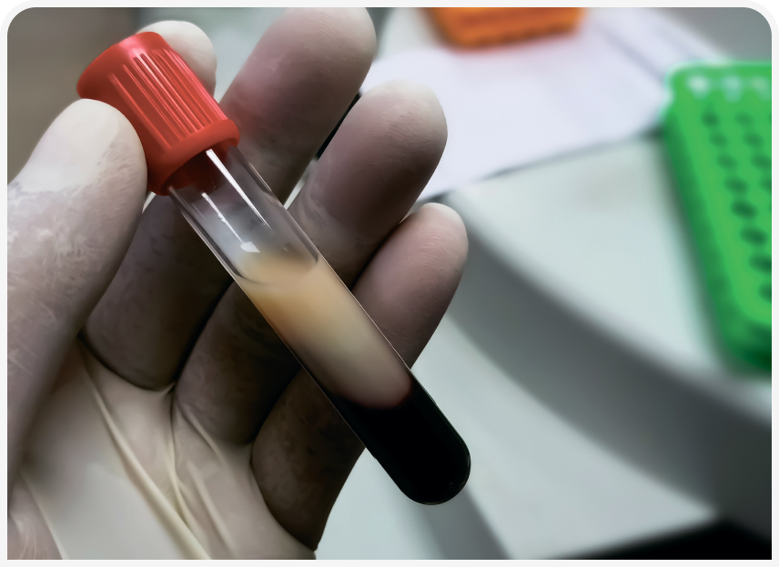 FOCUS-334-Leonard-Figure-4 (4).png