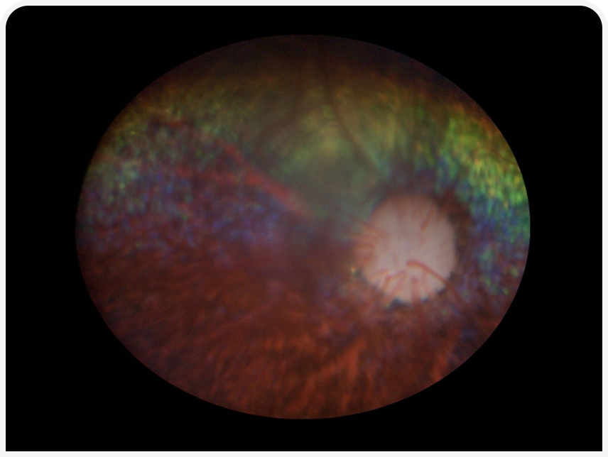 FOCUS (1).png