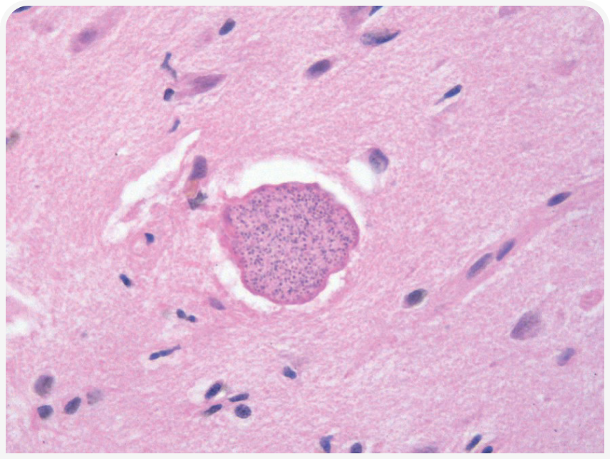 FOCUS-334-Leonard-Figure-2 (1).png