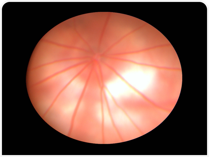 FOCUS (3).png