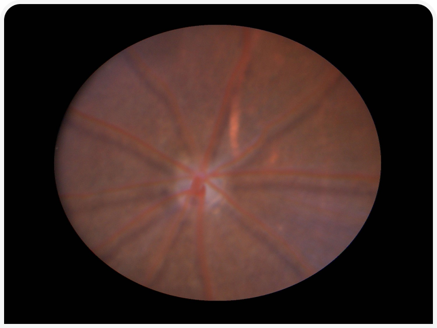 FOCUS (4).png