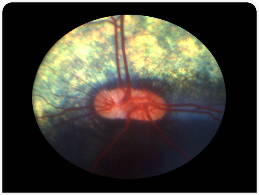 FOCUS (10).png
