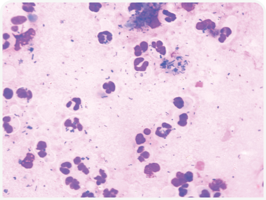 FOCUS-334-Leonard-Figure-2 (4).png