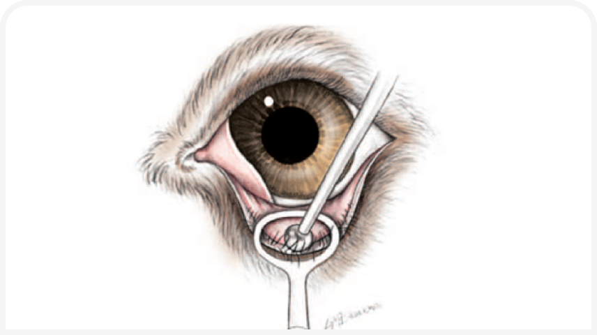 FOCUS (16).png